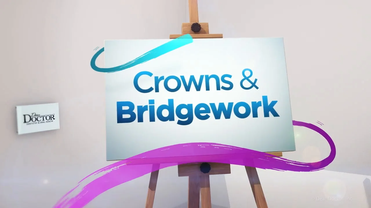 crowns and bridgework
