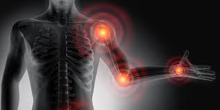 Inflammatory Conditions